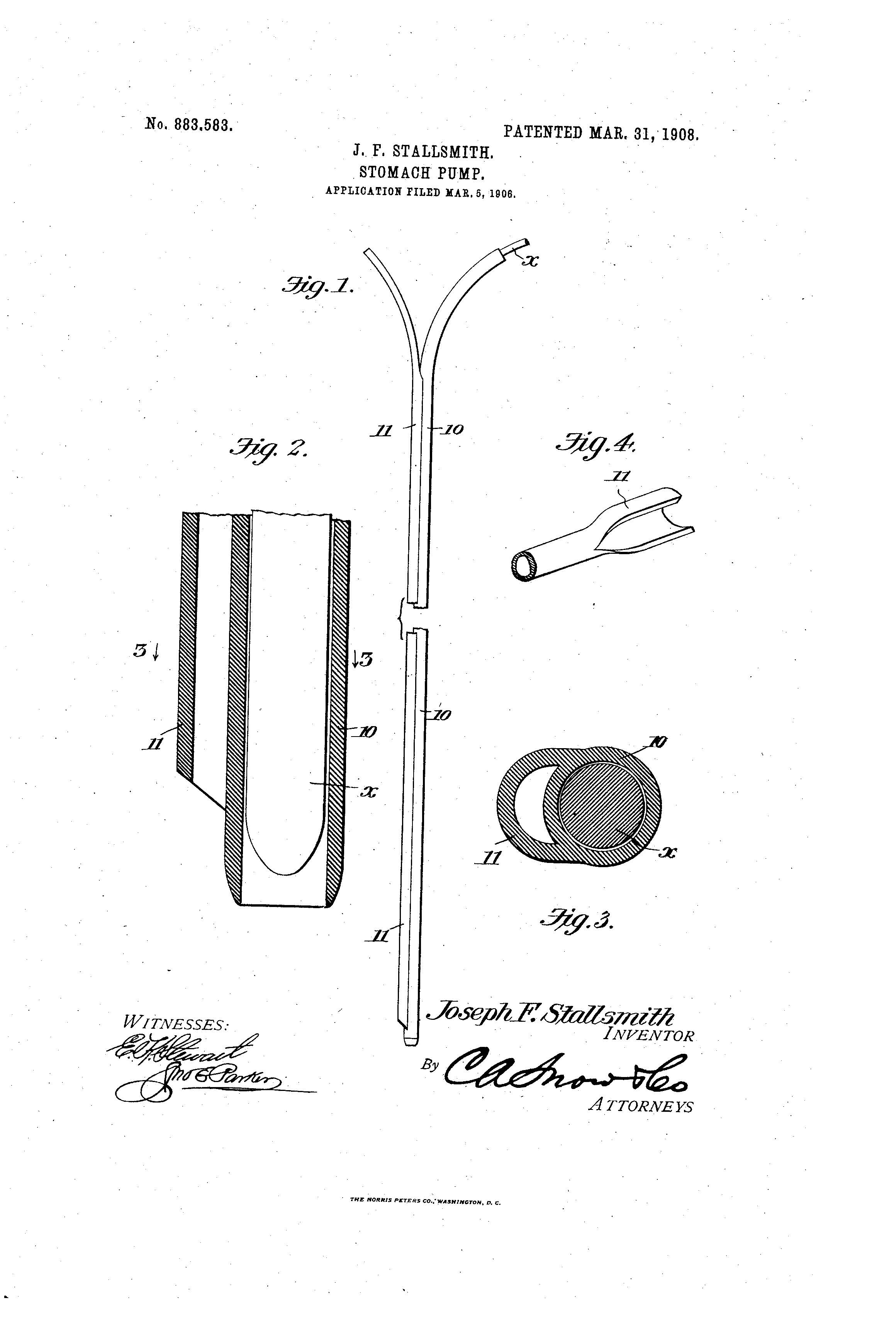 Patent-Illustration-Stomach-Pump
